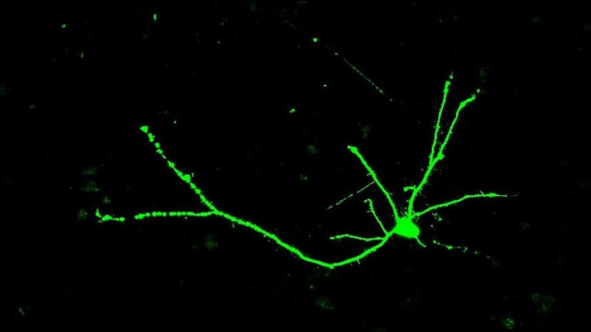سلول هاي عصبي به شکل درخت هستند - با جسم سلولي که شامل شاخه هاي زيادي در بالا، يک تنه بلند و يک سیستم ریشه¬ای منشعب در پايين سلول است.  